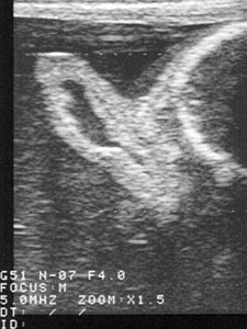 scan