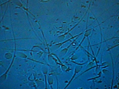 Equine Sperm